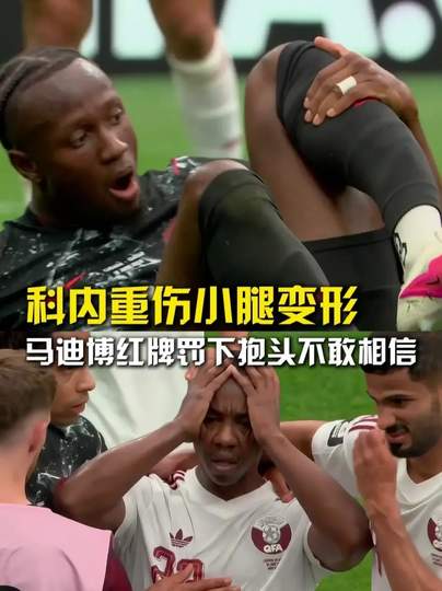 加拿大球员小腿恐怖变形！这场欧冠对决背后暗藏多少隐情？